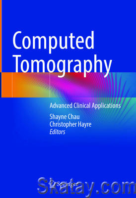 Computed Tomography. Advanced Clinical Applications
